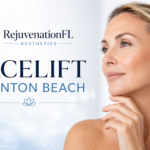 facelift Boynton Beach